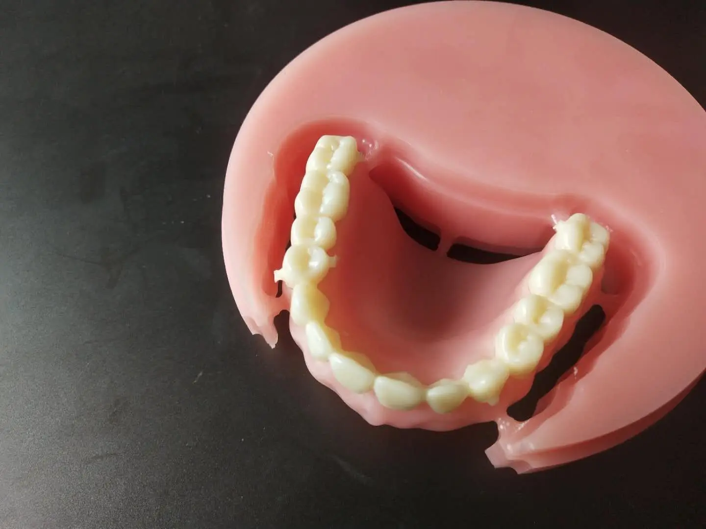 Removable Restorations